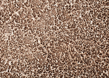 Similar image 7585592