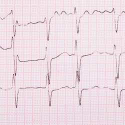 Similar image 7637230