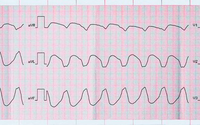 Similar image 7683214