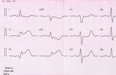 Similar image 7683217