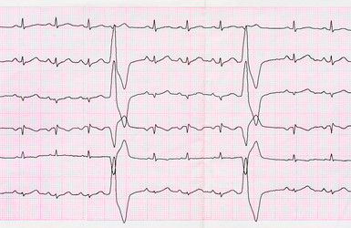 Similar image 7683218