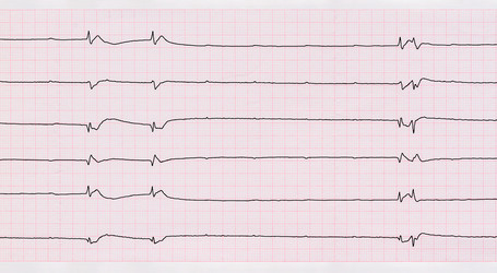 Similar image 7726348