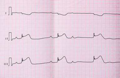 Similar image 7734225