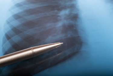 Similar image 7801700