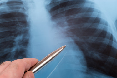 Similar image 7801701