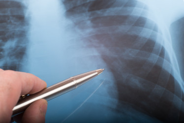 Similar image 7842655