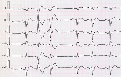 Similar image 7953354