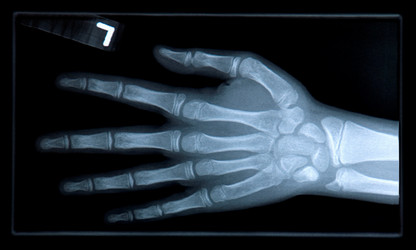 Similar image 7954423