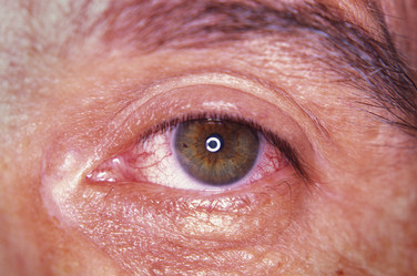 Similar image 8006464