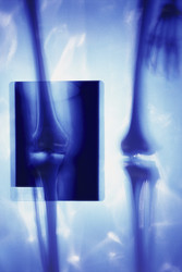 Similar image 8093933