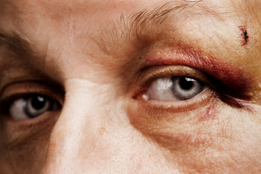 Similar image 8174895