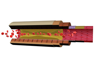 Similar image 8202910