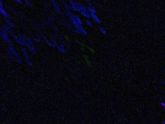 Similar image 8365650