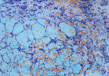 Similar image 8449035