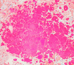 Similar image 8504449