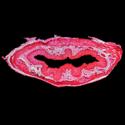 Similar image 8514215