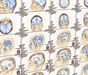 Similar image 11482258