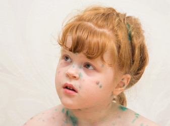 Similar image 11504161