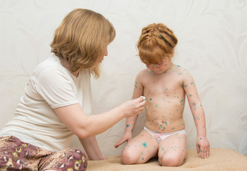 Similar image 11504179