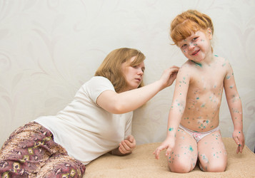 Similar image 11504182