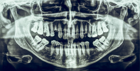 Similar image 11942196