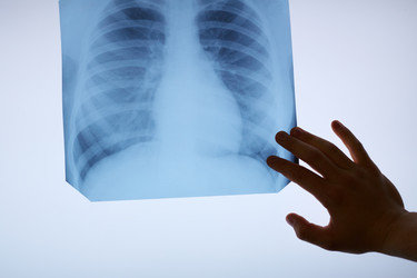 Similar image 11928972