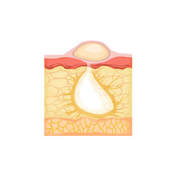 Similar image 11937901