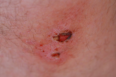 Similar image 12987721