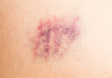 Similar image 13038354