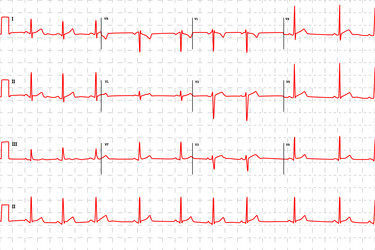 Similar image 13045454