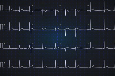 Similar image 13004531