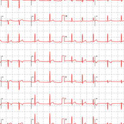 Similar image 13011961