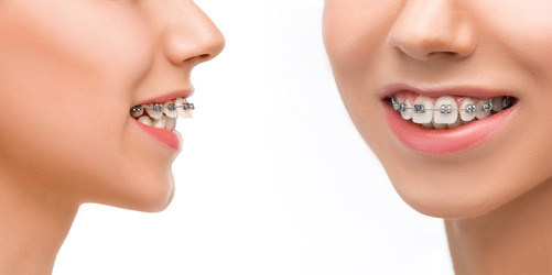 Similar image 13087332