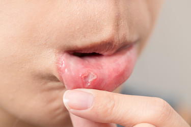 Similar image 13200997