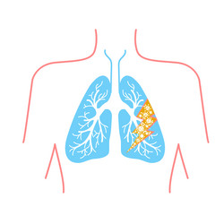 Similar image 13300179