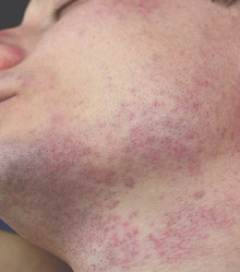 Similar image 16924037