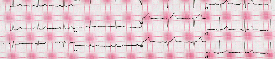 Similar image 17248527