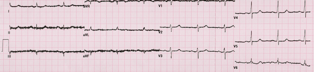 Similar image 17248533