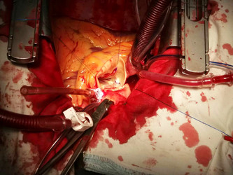 Similar image 19940813