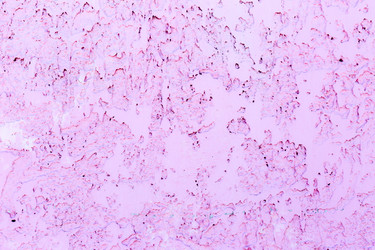 Similar image 20110309