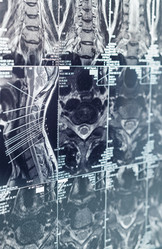 Similar image 20106211