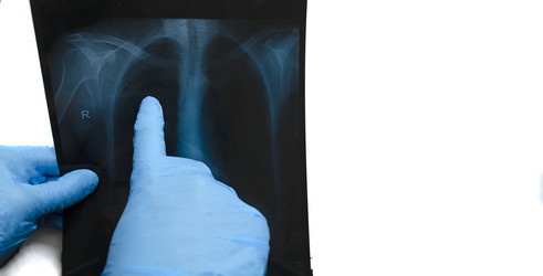 Similar image 20980187