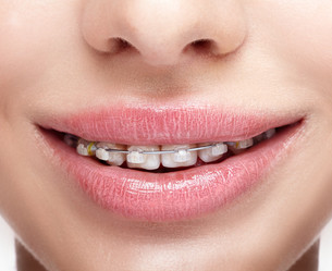 Similar image 21017843