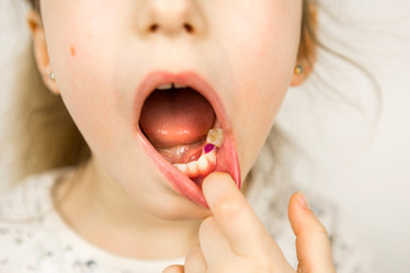 Similar image 21052176