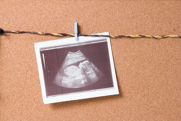 Similar image 21051461