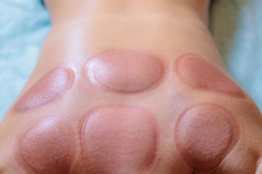 Similar image 21046478