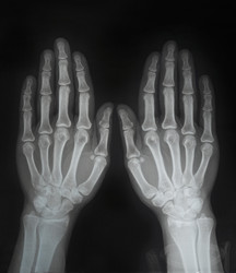 Similar image 21049742