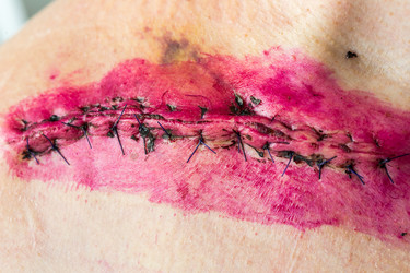 Similar image 21049292