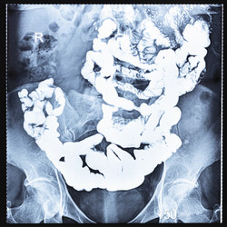 Similar image 21087284