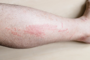 Similar image 21105671